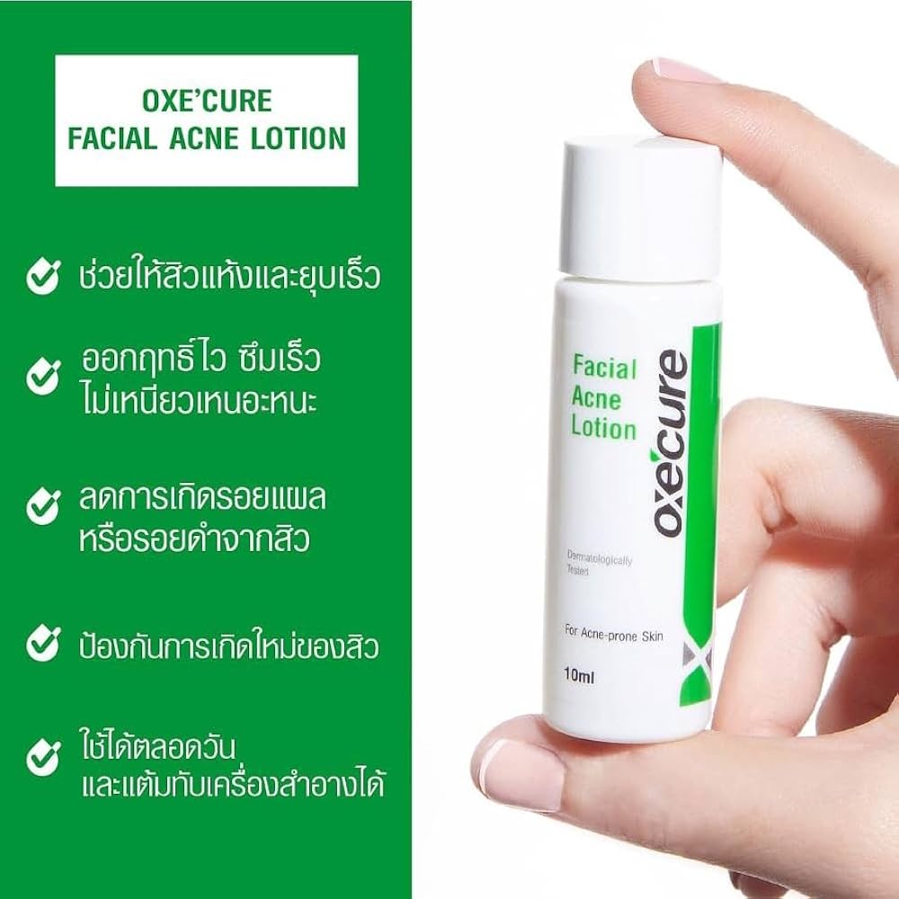 Amazon.com : Oxe-cure Facial Acne Lotion 10 ml : Beauty
